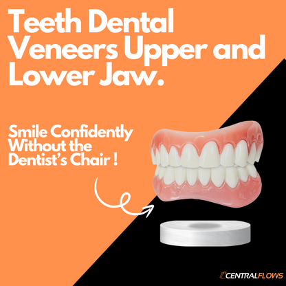 Dental Veneers Upper and Lower Jaw