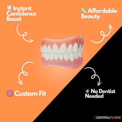 Dental Veneers Upper and Lower Jaw