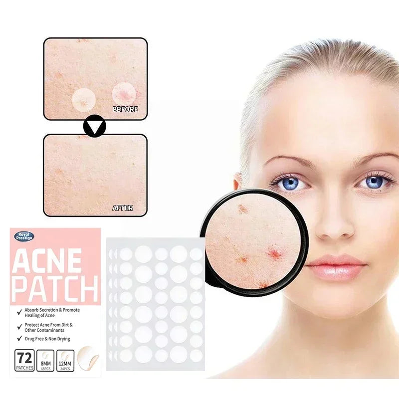 Pimple Patches