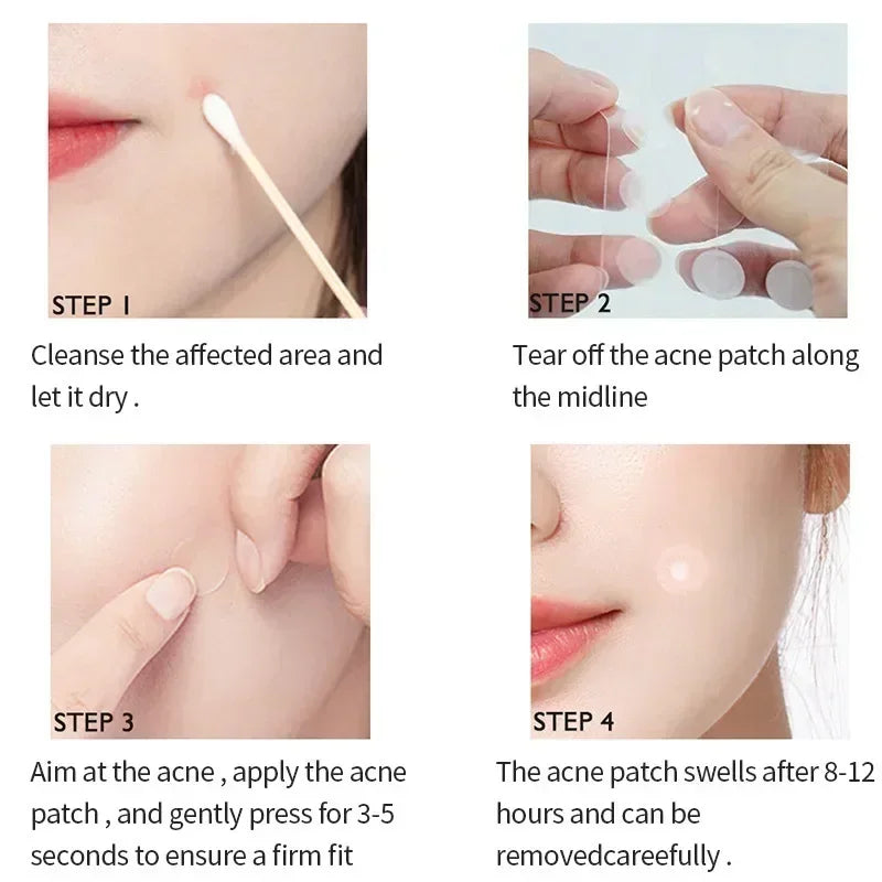 Pimple Patches