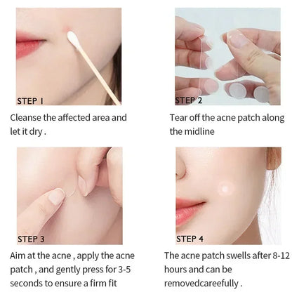 Pimple Patches